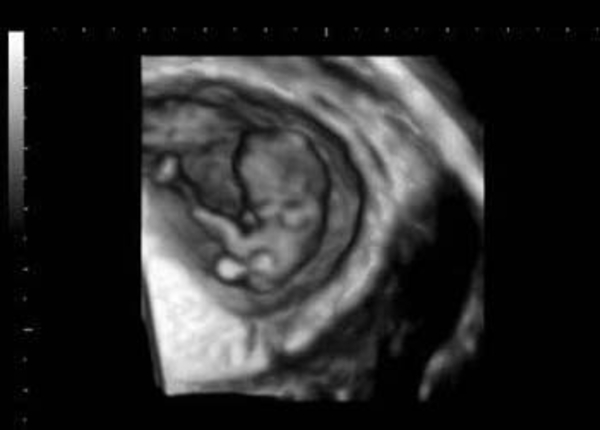 Random Photo Upload On Fri Apr 17th, 2009 at 2:09PM